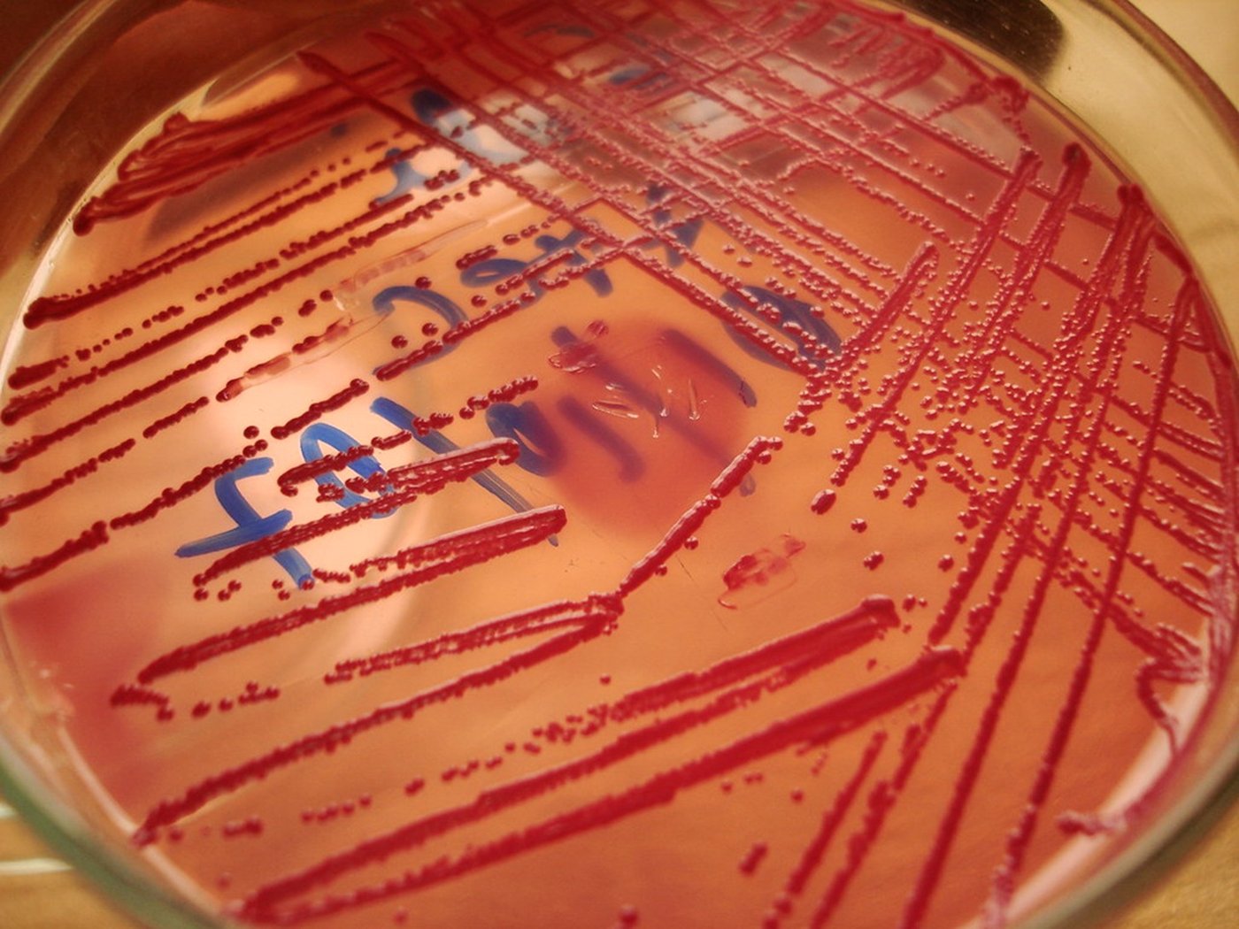Placa de cultivo con colonias microbianas en el laboratorio de Geomytsa
